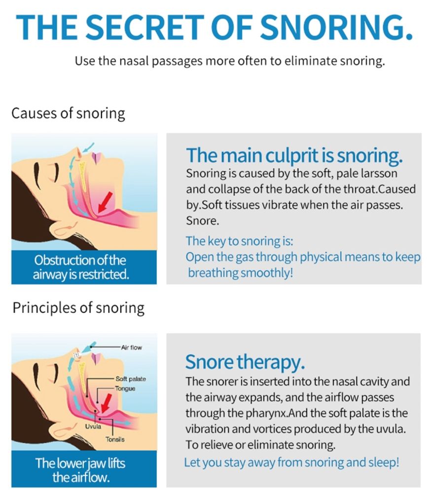 2-in-1 kuorsausta ehkäisevä nenän ilmanpuhdistin – valkoinen